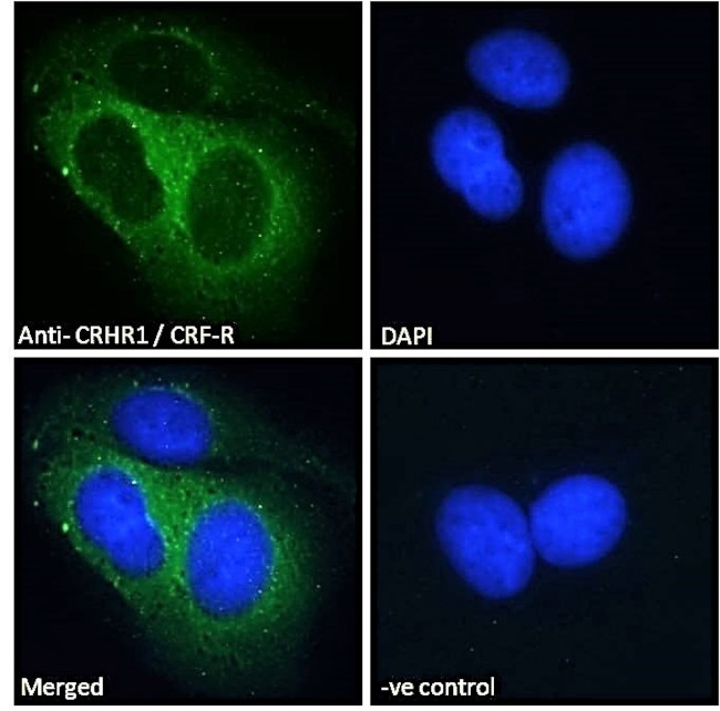 CRHR1 Antibody in Immunocytochemistry (ICC/IF)