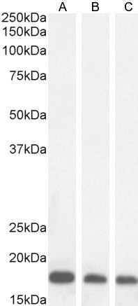 ARF1/ARF2/ARF3/ARF4 Antibody in Western Blot (WB)