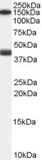 GALR1 Antibody in Western Blot (WB)