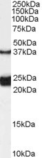 GALR1 Antibody in Western Blot (WB)