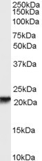 RBP4 Antibody in Western Blot (WB)