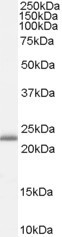 RBP4 Antibody in Western Blot (WB)