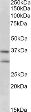 FGF23 Antibody in Western Blot (WB)