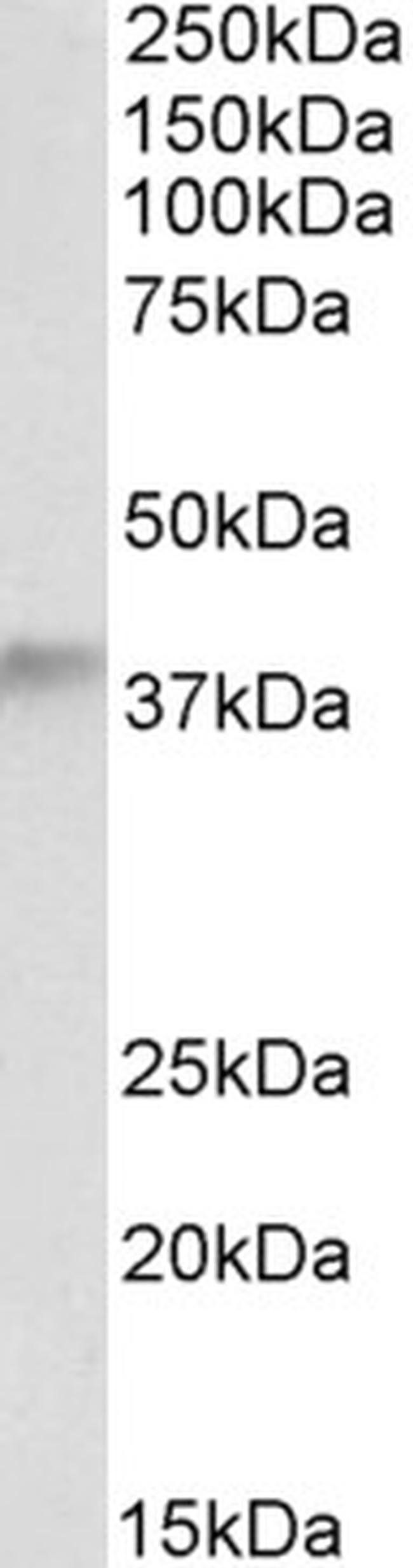 ADH5 Antibody in Western Blot (WB)