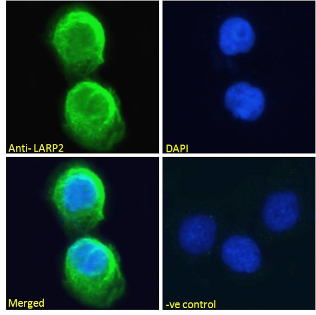 LARP2 Antibody in Immunocytochemistry (ICC/IF)