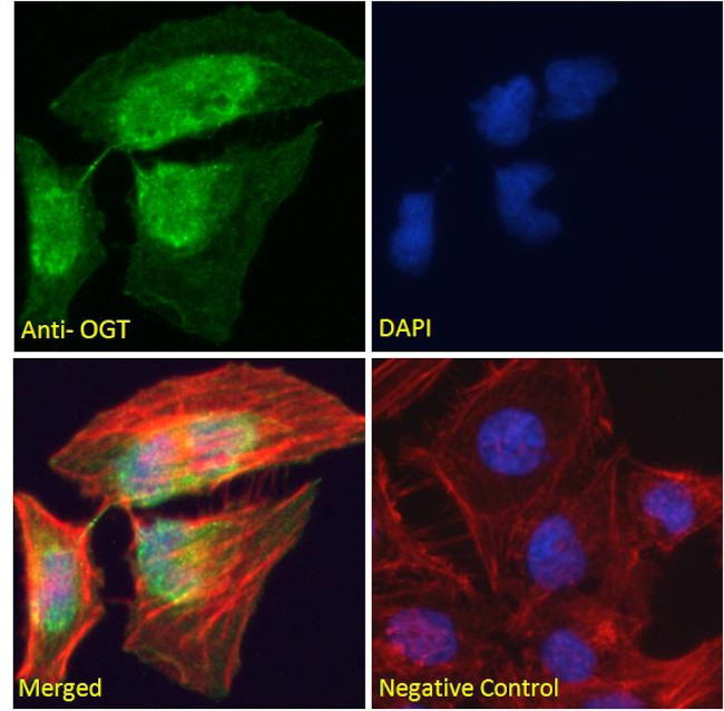 OGT Antibody in Immunocytochemistry (ICC/IF)