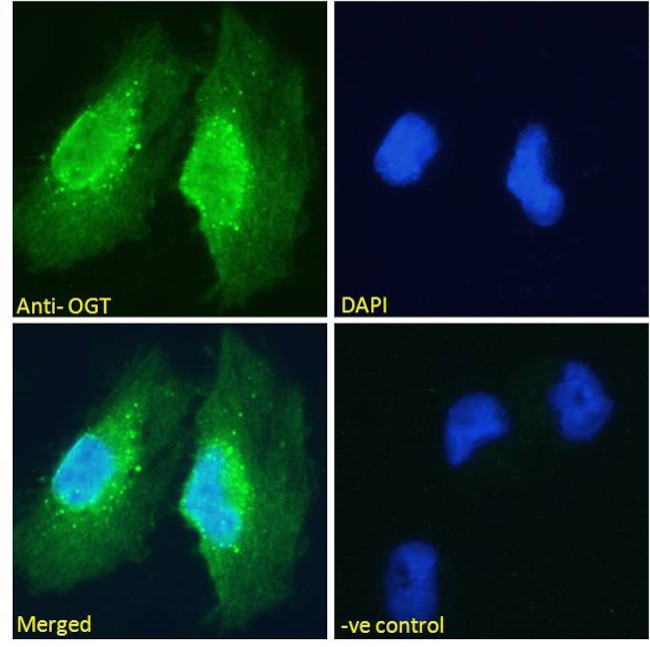 OGT Antibody in Immunocytochemistry (ICC/IF)