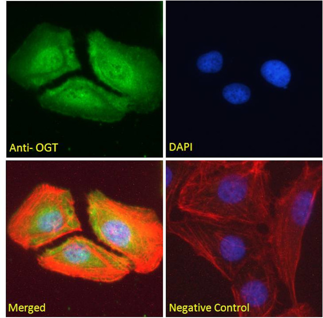 OGT Antibody in Immunocytochemistry (ICC/IF)