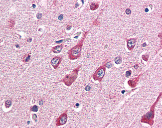 OGT Antibody in Immunohistochemistry (Paraffin) (IHC (P))