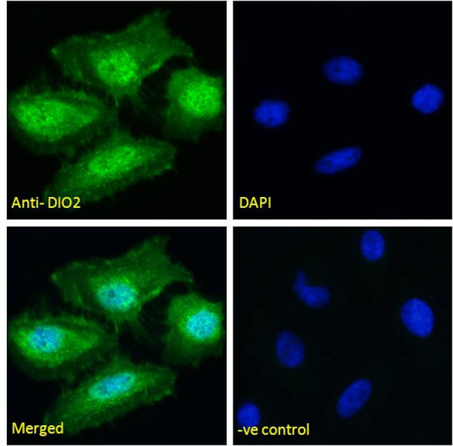 DIO2 Antibody in Immunocytochemistry (ICC/IF)