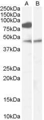 ZDHHC8 Antibody in Western Blot (WB)