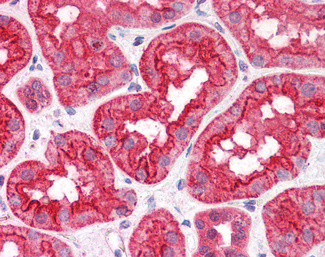 CGI58 Antibody in Immunohistochemistry (Paraffin) (IHC (P))