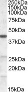 CGI58 Antibody in Western Blot (WB)