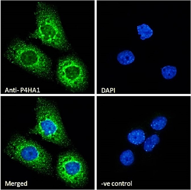 P4HA1 Antibody in Immunocytochemistry (ICC/IF)