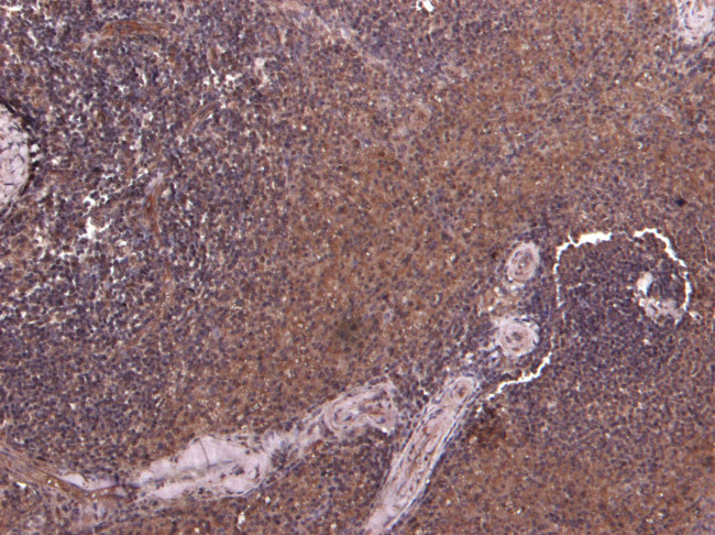 P4HA1 Antibody in Immunohistochemistry (Paraffin) (IHC (P))