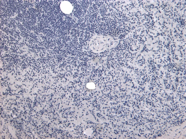 P4HA1 Antibody in Immunohistochemistry (Paraffin) (IHC (P))