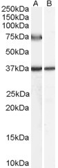 ACOX2 Antibody in Western Blot (WB)