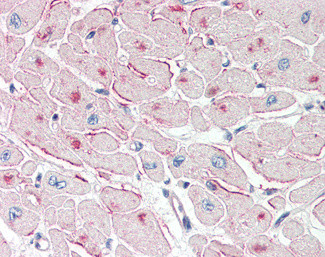 ATGL Antibody in Immunohistochemistry (Paraffin) (IHC (P))