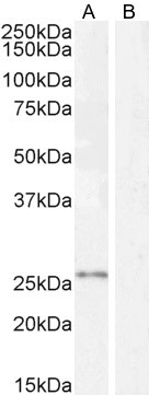 Kallikrein 2 Antibody in Western Blot (WB)