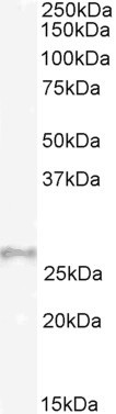 Gpx3 Antibody in Western Blot (WB)