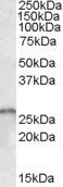 SMN1/SMN2 Antibody in Western Blot (WB)