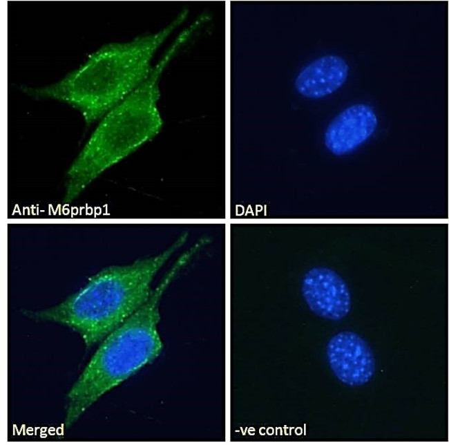 TIP47 Antibody in Immunocytochemistry (ICC/IF)