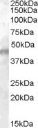 Kir6.2 (KCNJ11) Antibody in Western Blot (WB)