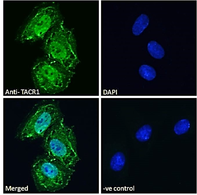 TACR1 Antibody in Immunocytochemistry (ICC/IF)
