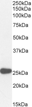 PAX6 Antibody in Western Blot (WB)