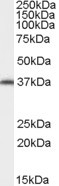 AIP Antibody in Western Blot (WB)