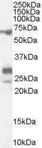 SALL4 Antibody in Western Blot (WB)