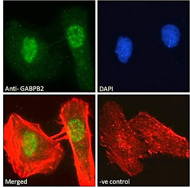 GABPB2 Antibody in Immunocytochemistry (ICC/IF)