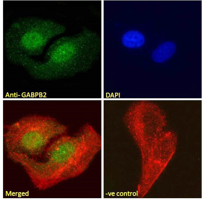 GABPB2 Antibody in Immunocytochemistry (ICC/IF)