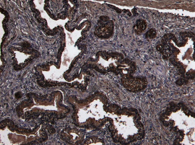 CD26 Antibody in Immunohistochemistry (Paraffin) (IHC (P))