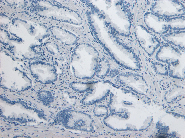 CD26 Antibody in Immunohistochemistry (Paraffin) (IHC (P))