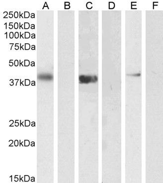 PTF1A Antibody in Western Blot (WB)