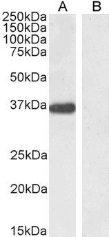 PTF1A Antibody in Western Blot (WB)