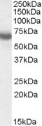 IKAROS Antibody in Western Blot (WB)