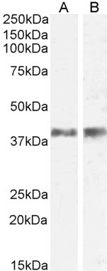 IL-12 p40 Antibody in Western Blot (WB)