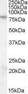 FMRP Antibody in Western Blot (WB)