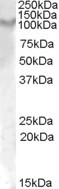 IL17RA Antibody in Western Blot (WB)