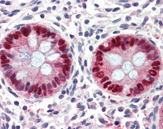 EGR2 Antibody in Immunohistochemistry (Paraffin) (IHC (P))