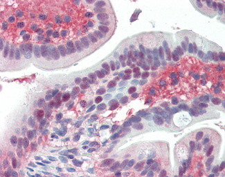 EGR2 Antibody in Immunohistochemistry (Paraffin) (IHC (P))