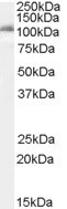 IDE Antibody in Western Blot (WB)