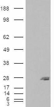 SAR1B Antibody in Western Blot (WB)