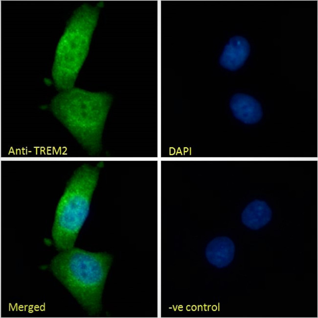 TREM2 Antibody in Immunocytochemistry (ICC/IF)