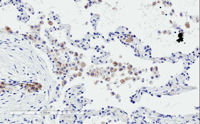 TREM2 Antibody in Immunohistochemistry (Paraffin) (IHC (P))