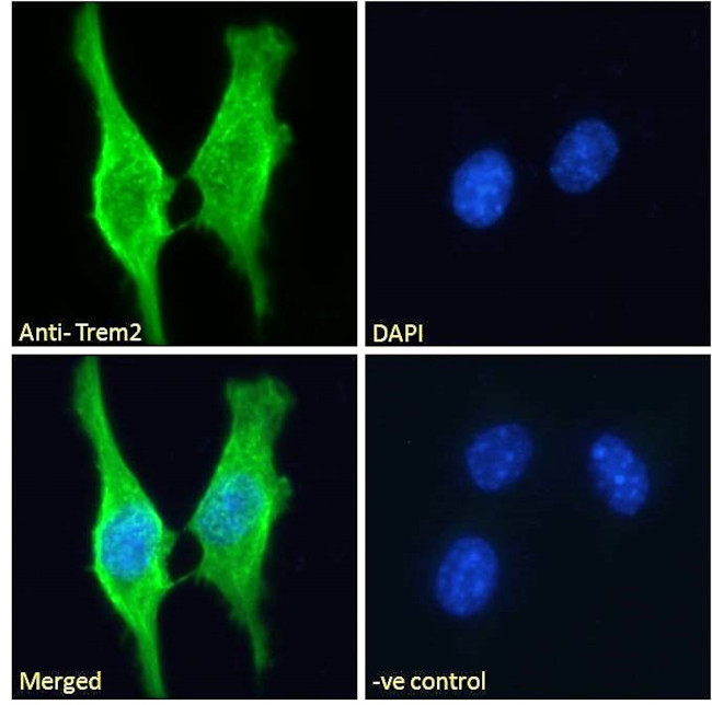 TREM2 Antibody in Immunocytochemistry (ICC/IF)