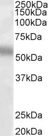 TFEB Antibody in Western Blot (WB)