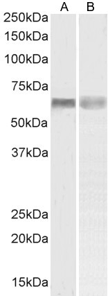 PINK1 Antibody in Western Blot (WB)